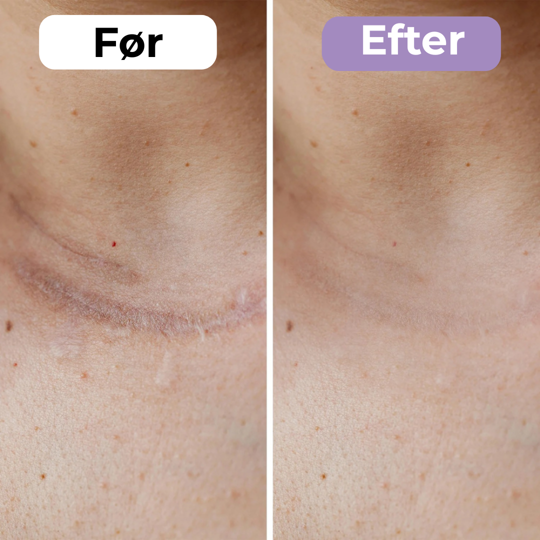 SilkoPude™ – Skønhed mens du hviler