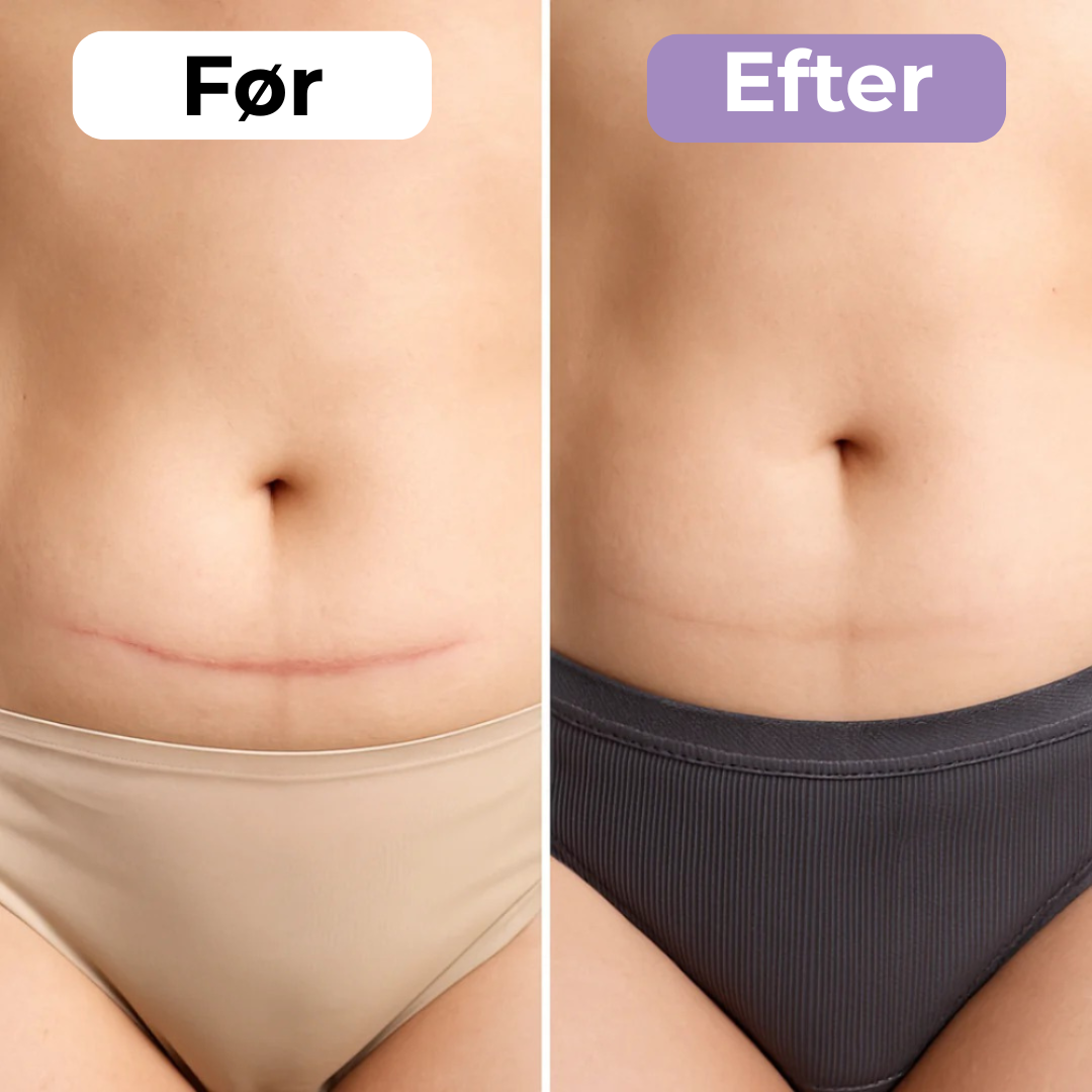 SilkoPude™ – Skønhed mens du hviler