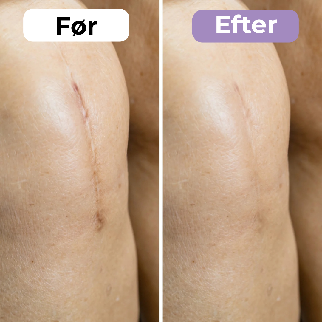 SilkoPude™ – Skønhed mens du hviler