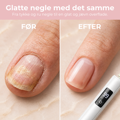 NailPro™ - Professionelle negle — hjemme fra din egen stue!