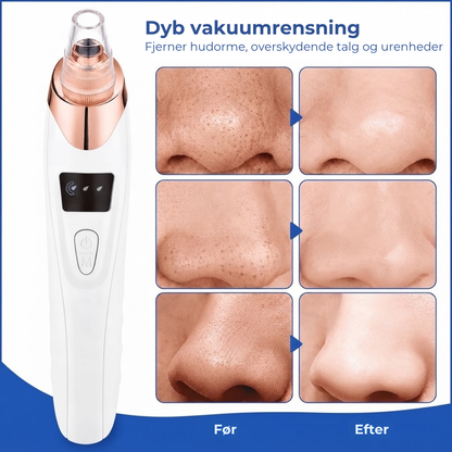 PoreRens™ - Rens porerne og få en glattere og sundere hud!