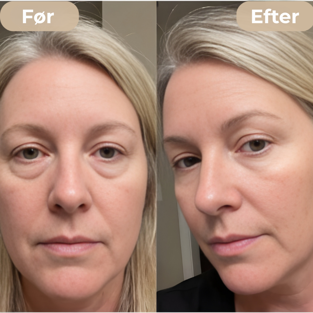 ØjenGlød™ - Sig farvel til træthed og mørke rande!