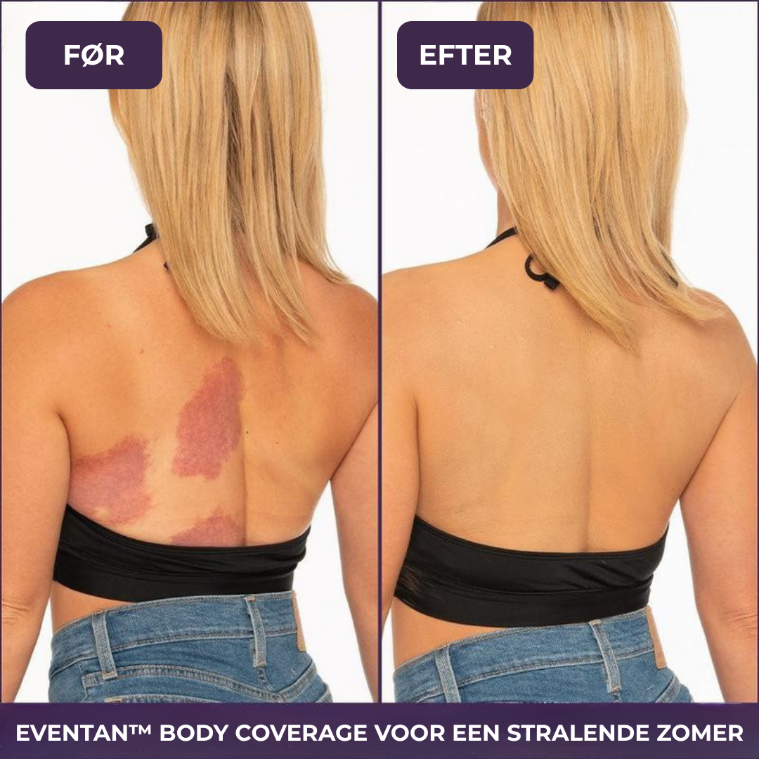 EvenTan™ - Den perfekte creme til hele kroppen!