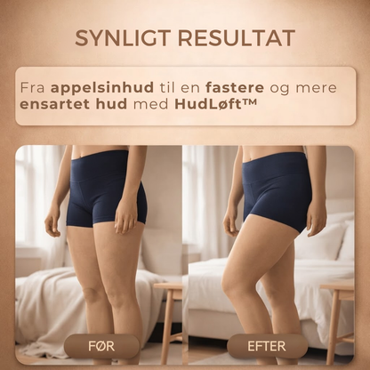 HudLøft™ - Stram og form din hud med vacuummassage!