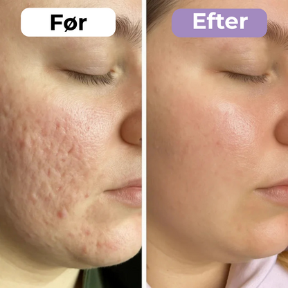 SilkoPude™ – Skønhed mens du hviler