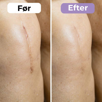 SilkoPude™ – Skønhed mens du hviler